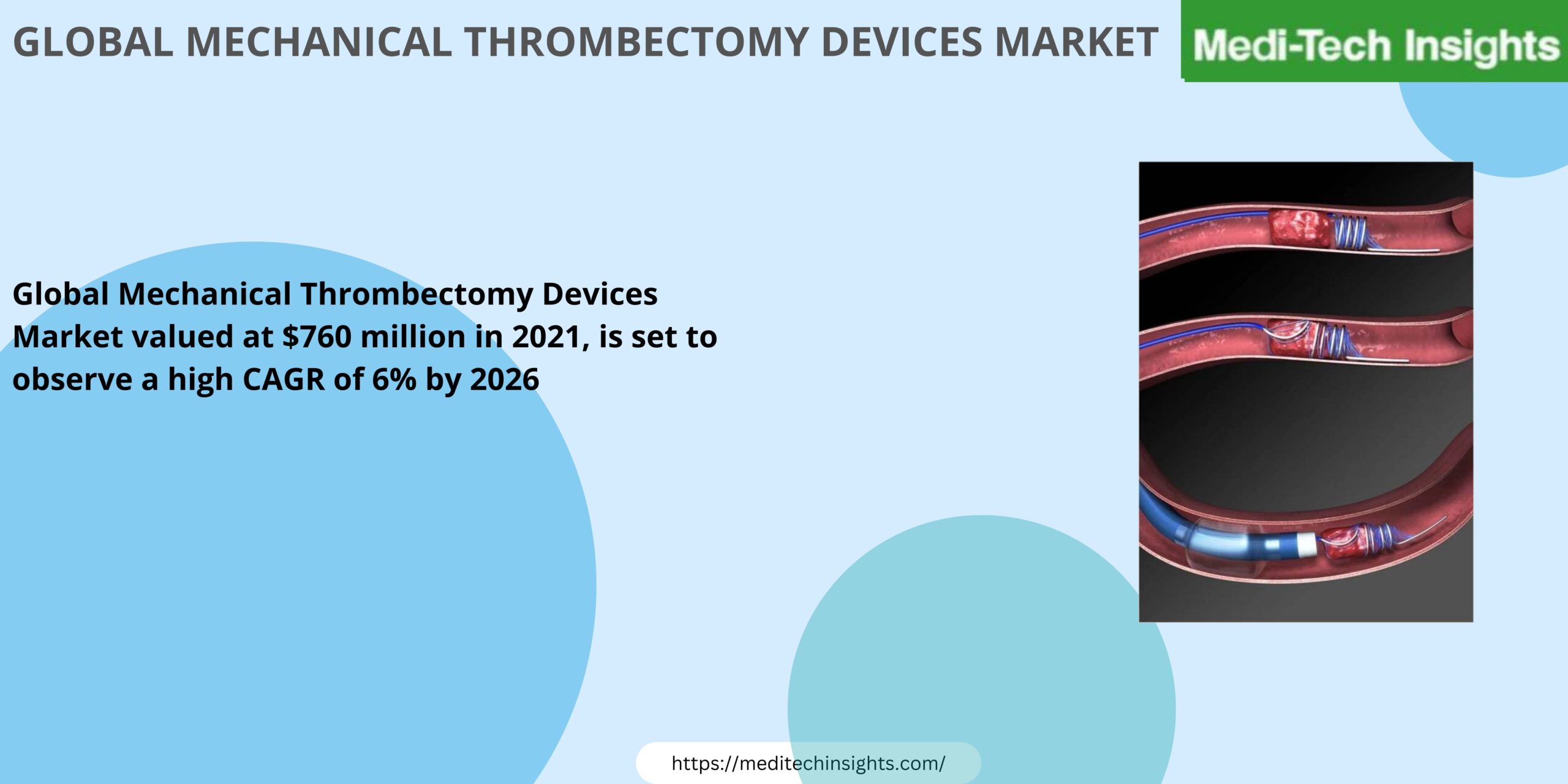 Mechanical Thrombectomy Devices