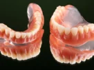 Dental Prosthetics Market